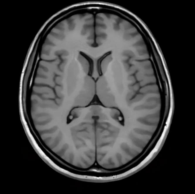 Enhancing Imaging Quality