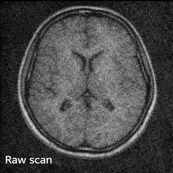 Raw medical scan prepared for data ingestion