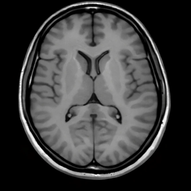 Refined enhanced medical imaging output